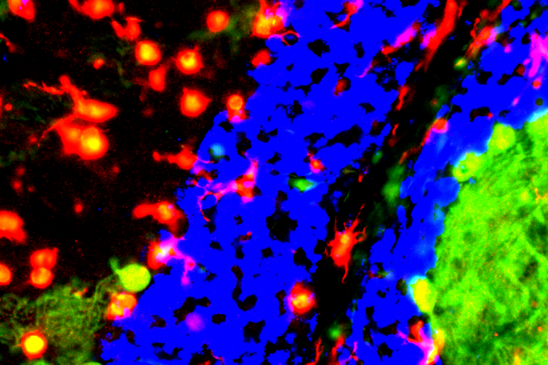 Cellule della microglia di topo (fonte: NICHD/A. Cougnoux, F.D. Porter) - RIPRODUZIONE RISERVATA