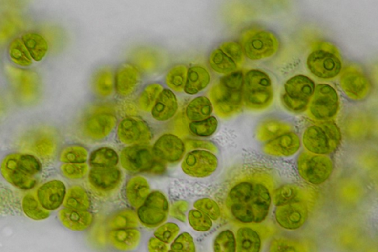 La nuova specie di alga microscopica chiamta Gormaniella terricola in onore della poetessa americana Amanda Gorman (fonte: Louise Lewis, University of Connecticut) - RIPRODUZIONE RISERVATA